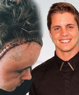 Johnny Ruffo Is Officially Cancer-Free