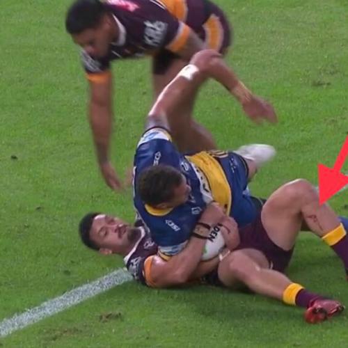 Broncos Captain Alex Glenn Will Undergo Surgery After Suffering Serious Leg Laceration