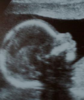 Apparently, You Can Tell The Gender Of This Baby Based Off Its Heartbeat?!